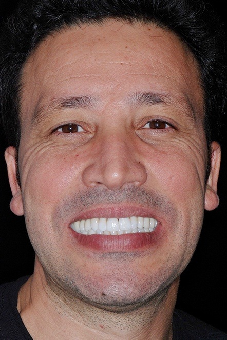 Ali, dental patient smiling after dental implant treatment