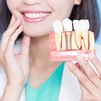 dentist holding model of dental implants in Allen