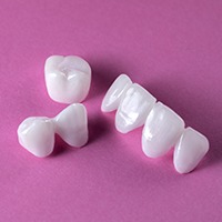 Dental crown and bridge restorations prior to placement