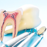 Cross-section tooth model next to dental instruments against light background 
