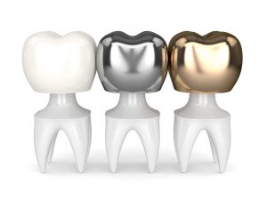 three dental crowns