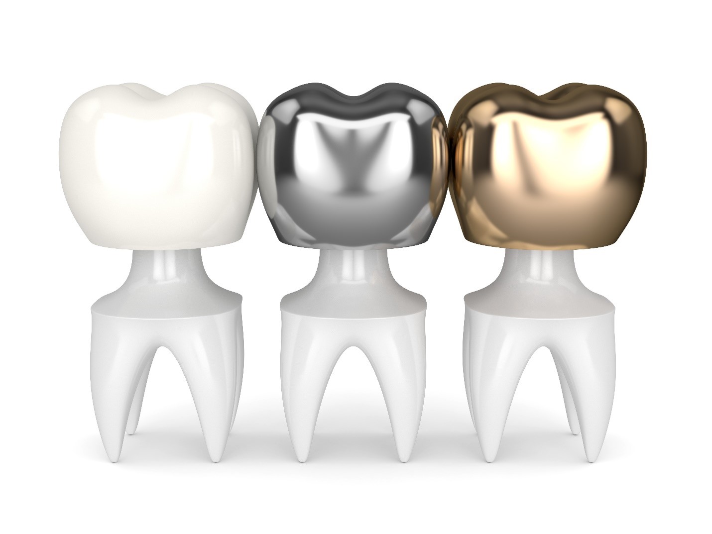 Does It Matter What My Dental Crown Is Made Of? Does It Matter What My Dental Crown Is Made Of?