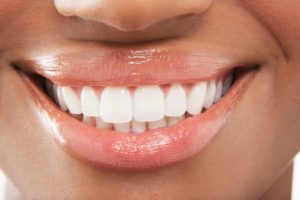 Close-up of woman’s perfect teeth with porcelain veneers or Lumineers